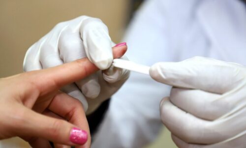 CDMX elimina el delito «Peligro de Contagio» para personas con VIH