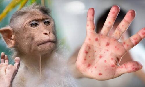 Hombre en Hong Kong infectado con virus B tras ataque de mono
