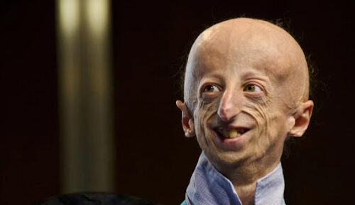 Fallece Sammy Basso, el científico que luchó contra la progeria y se convirtió en un símbolo de esperanza