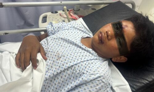 Trasladan a Veracruz a niño de 14 años agredido brutalmente en Tlalixcoyan