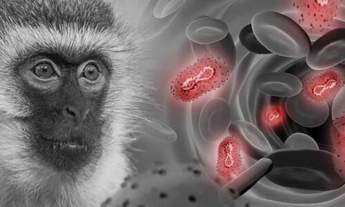 Oaxaca confirma un caso de viruela del mono: lo que sabemos