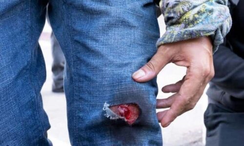 Le disparan a fotógrafo mexicano en protesta en Los Ángeles